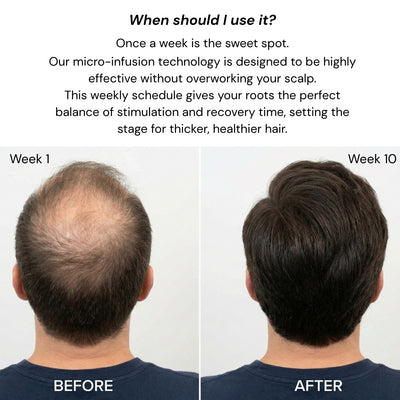 DearRoot™ Hair Regrowth System