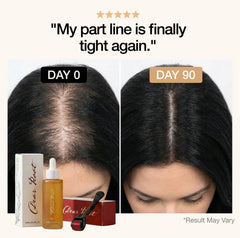 DearRoot™ Hair Serum
