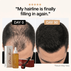 DearRoot™ Regrowth System Serum