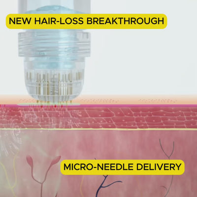 DearRoot™ Hair Regrowth System