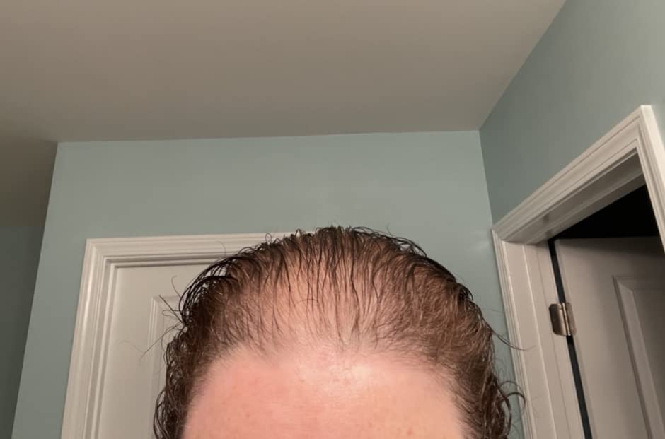 Customer result