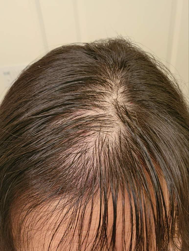 Customer result